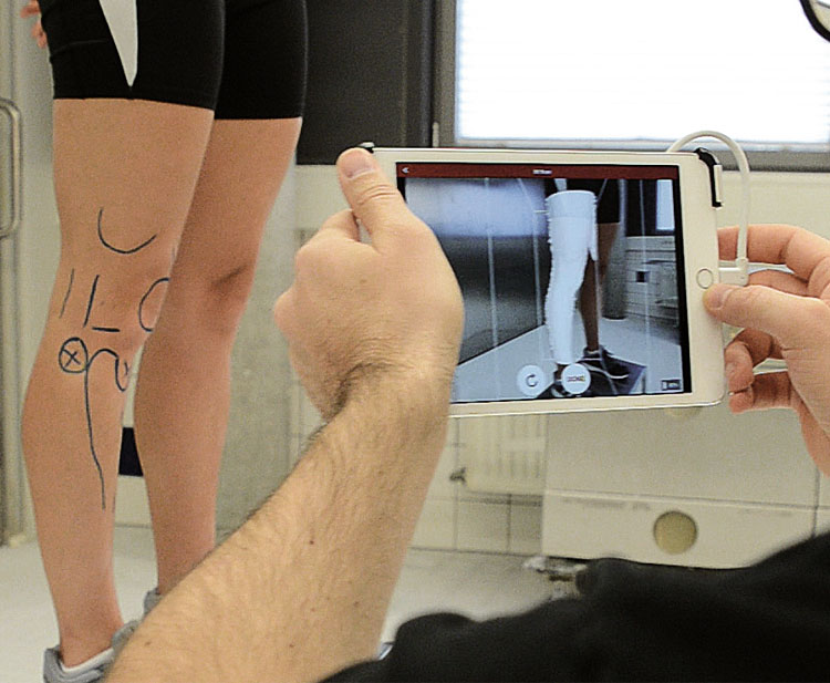 3D-Scan Knee brace